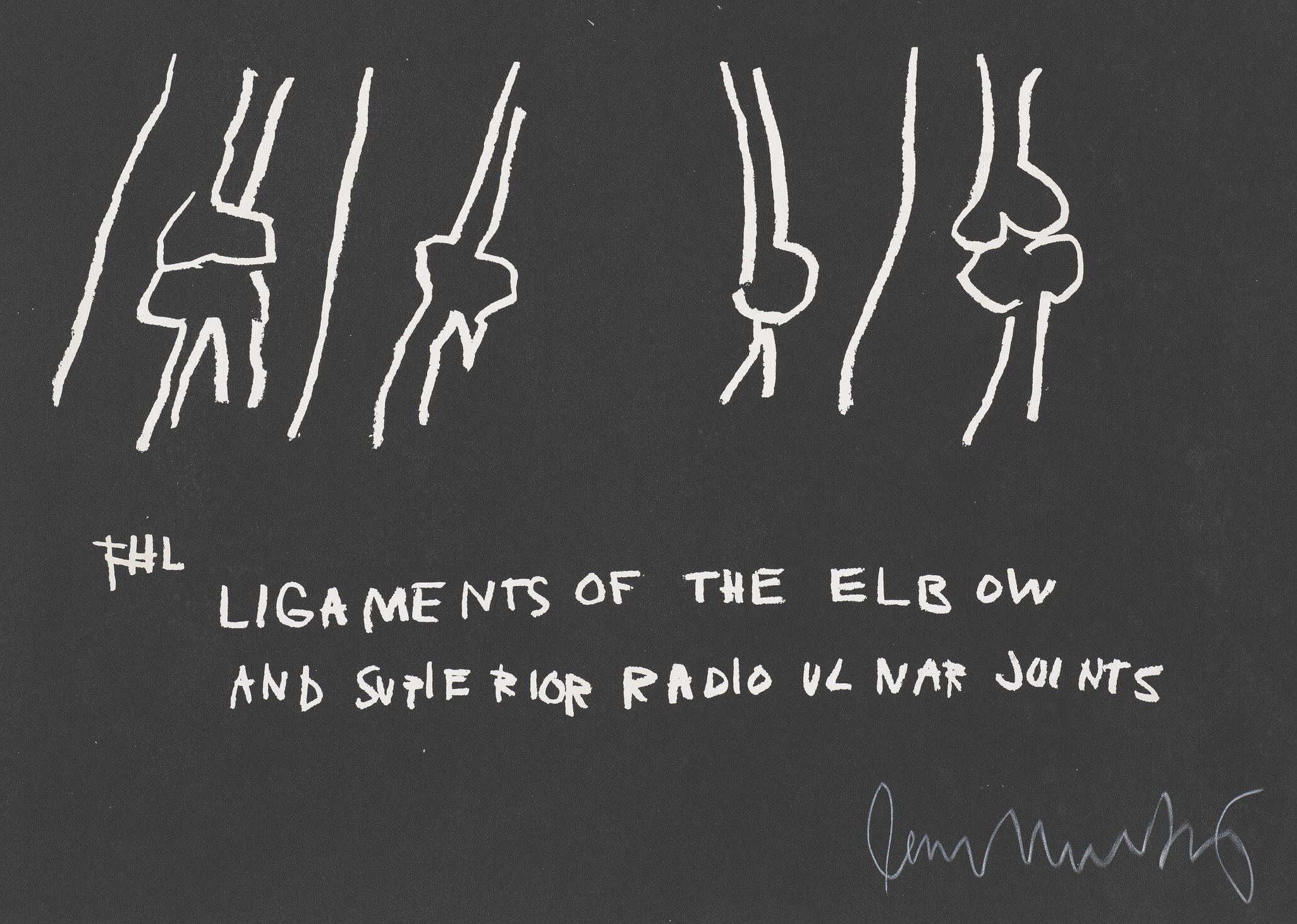 Jean-Michel Basquiat - Untitled (The Ligaments of the Elbow and Superior Radio Ulnar Joints), from Anatomy