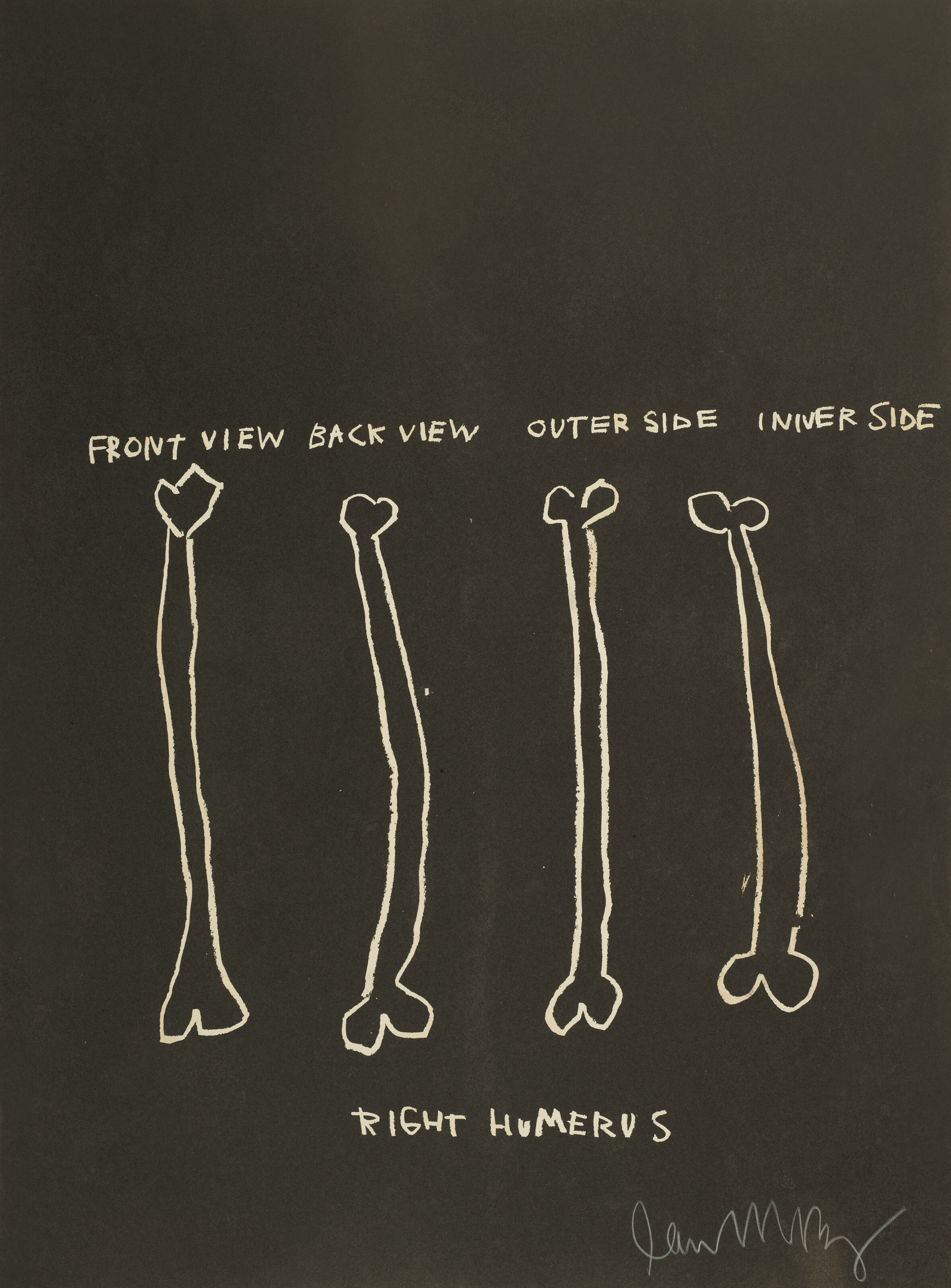 Jean-Michel Basquiat - Untitled (Right Humerus) From Anatomy